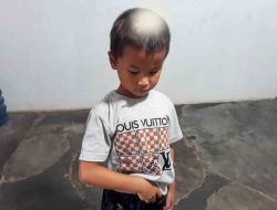 2 Tahun Lalu Keluarganya Dibantai, Bocah ini Masih Trauma, Kepala – Tangan Belum Pulih, Terlupakan Pemerintah?