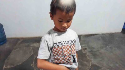 2 Tahun Lalu Keluarganya Dibantai, Bocah ini Masih Trauma, Kepala – Tangan Belum Pulih, Terlupakan Pemerintah?