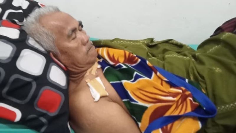 Duel Berdarah! Warga Semaka Tanggamus Lawan Buaya dan Alami Luka Robek