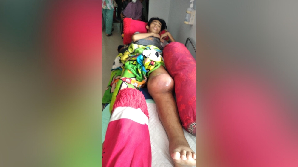 Kisah Haru Pelajar SMAN 1 Kota Agung Berjuang Melawan Kanker