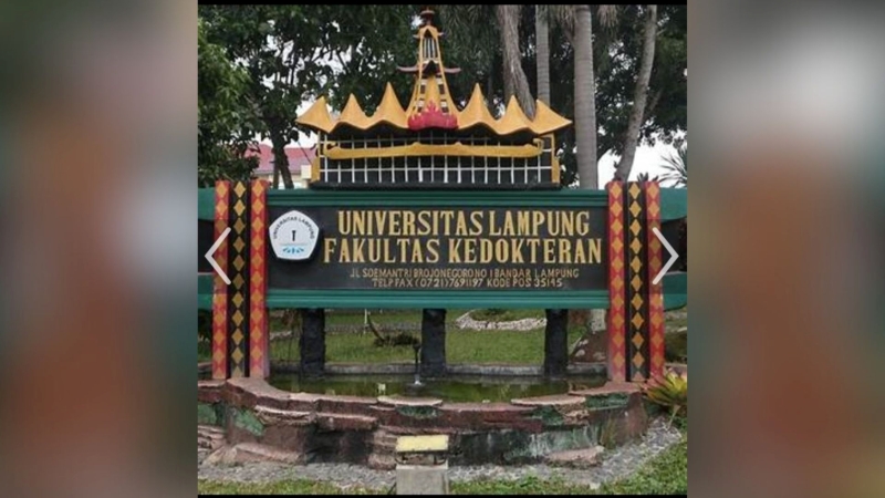 Unila Buka Prodi Sarjana Gizi, Jawab Tantangan Gizi Masyarakat Lampung