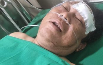 SWI Kecam Keras Penyerangan Jurnalis di Aceh Besar, Desak Polisi Usut Tuntas